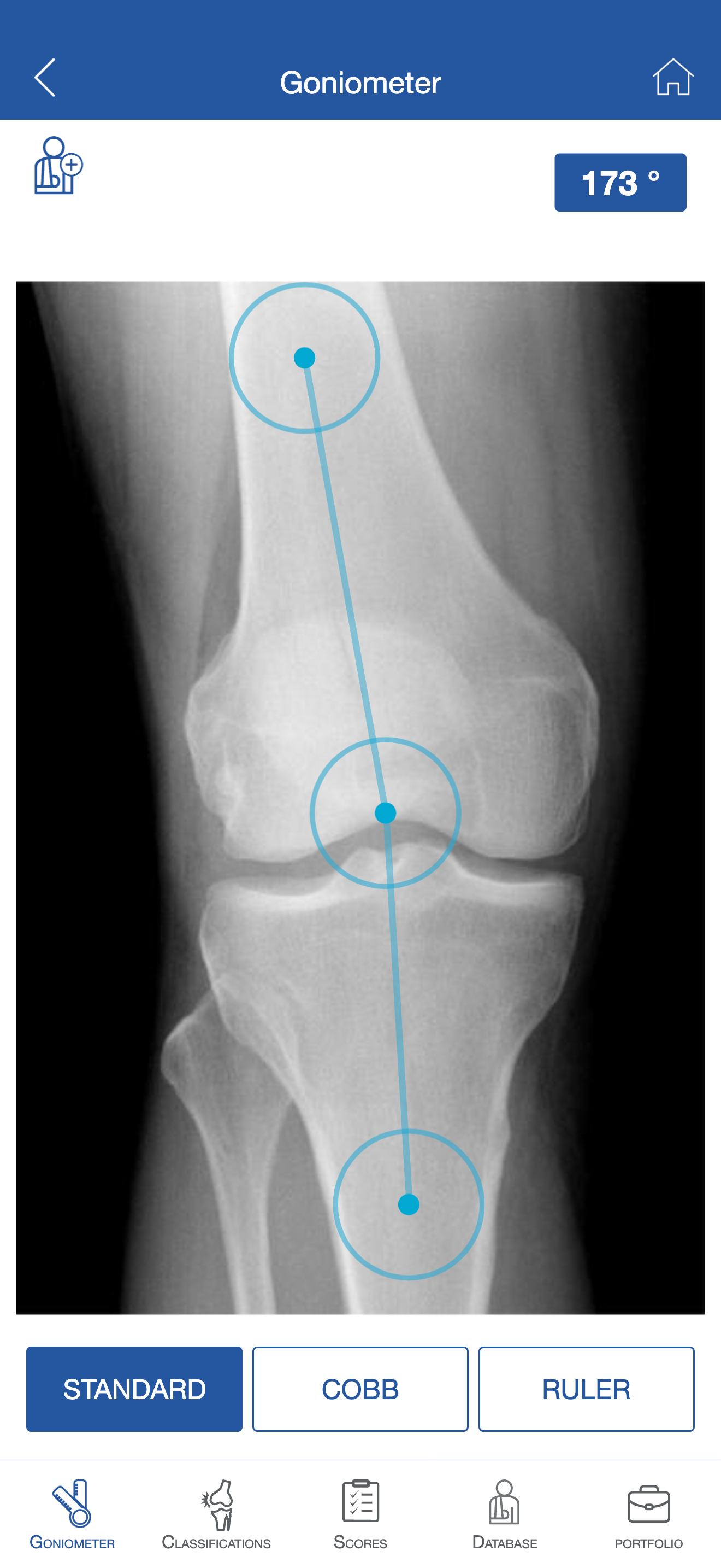 CJOrtho Screenshot 2